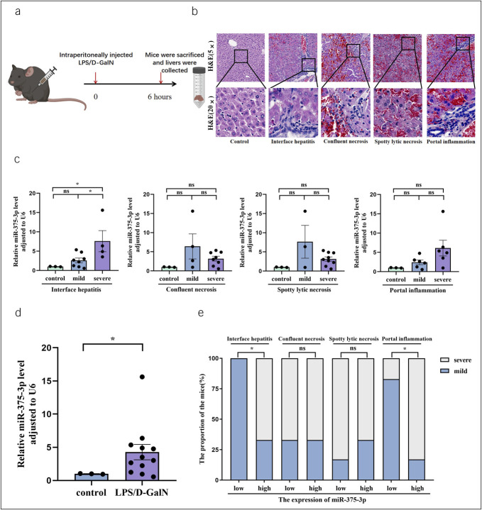 Downregulated Expression of Serum Exosome-Derived miR-375-3p Alleviates Interface Hepatitis and Promotes Fibrosis Regression in Patients With Chronic Hepatitis B.