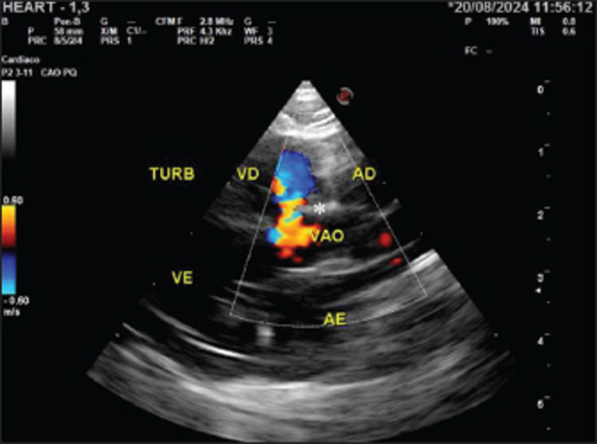 Peritoneo pericardial hernioplasty in a 2-month-old Shih Tzu.