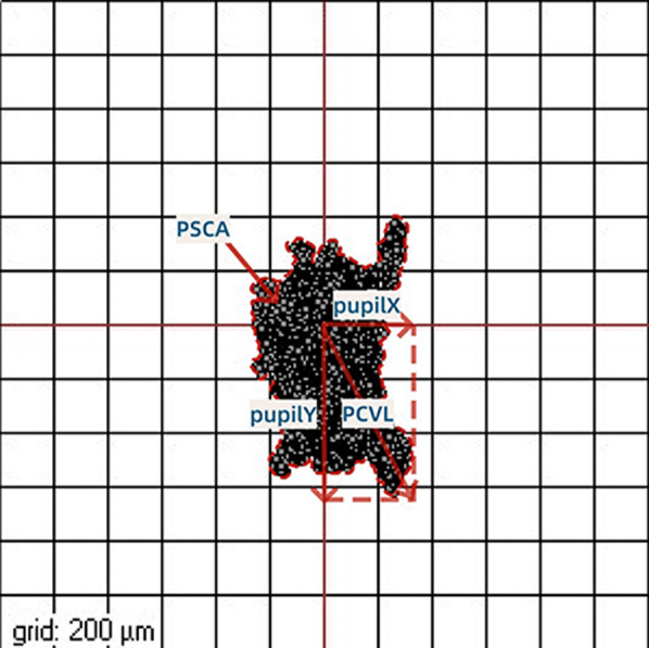 The effects of fixation stability, corneal density, and epithelial hyperplasia on the efficacy of astigmatism correction by transepithelial photorefractive keratectomy.