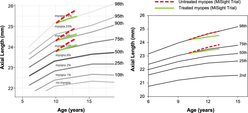 The limitations of centile curves for evaluating myopic eye growth.
