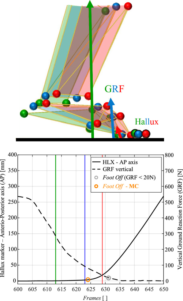 Automatic detection of human gait events: a simple but versatile 3D algorithm.