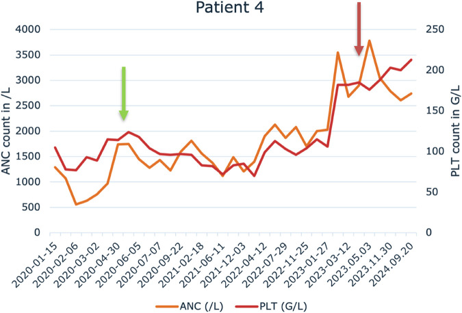 Successful treatment of hairy cell leukaemia with pegylated interferon-alpha-2A.