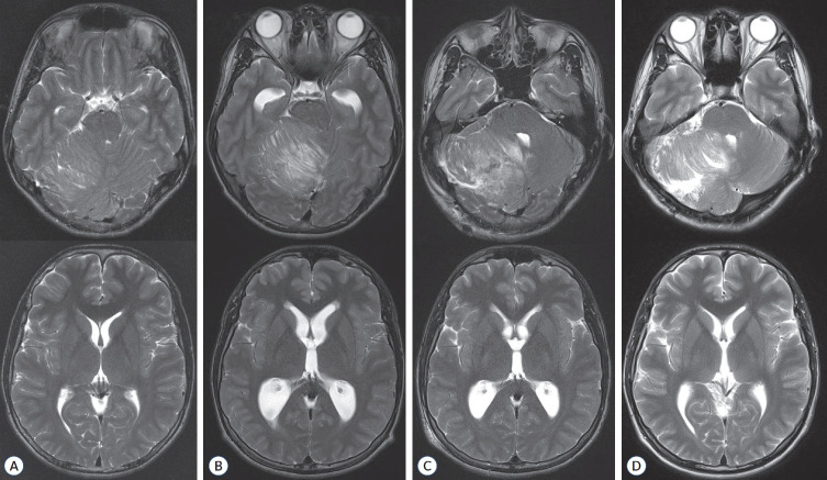 Germline Variants in Pediatric Cancer : Based on Oncogenic Pathways.
