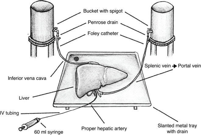 Creating a sustainable and inexpensive dry animal training model for liver surgery in low- and middle-income countries.