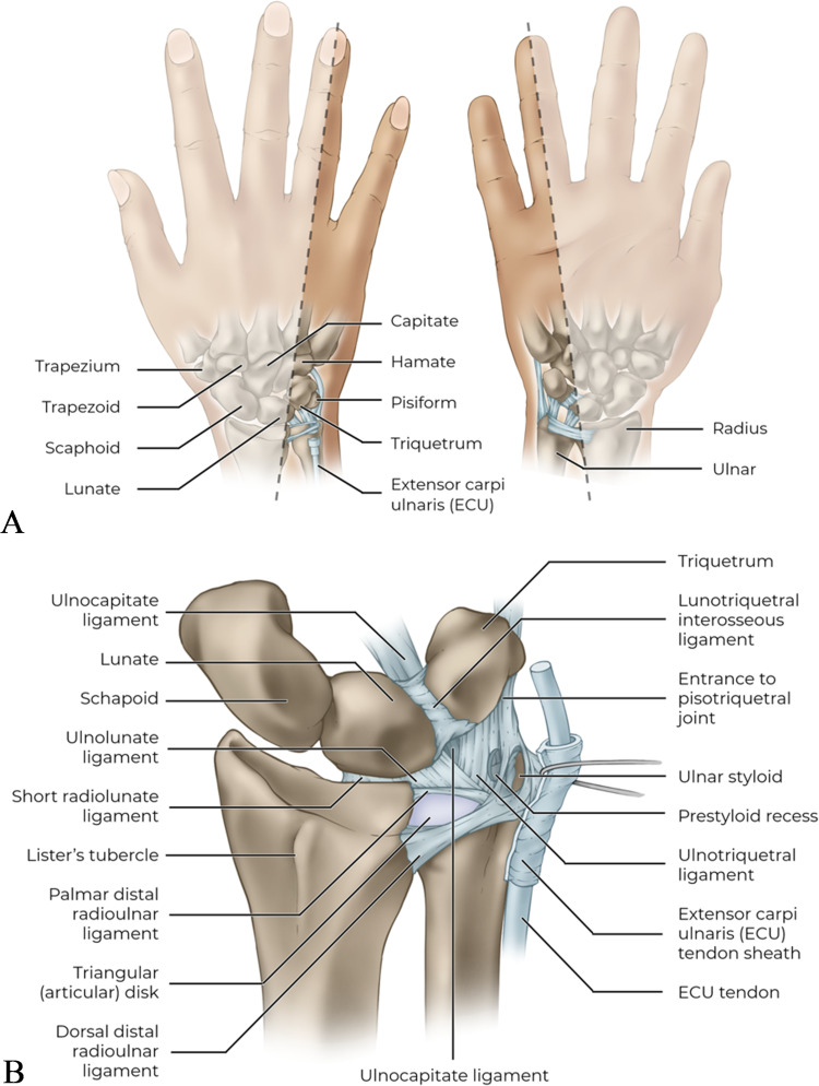 Ulnar-Sided Wrist Pain: Systematic Clinical Approach and Principles of Treatment.