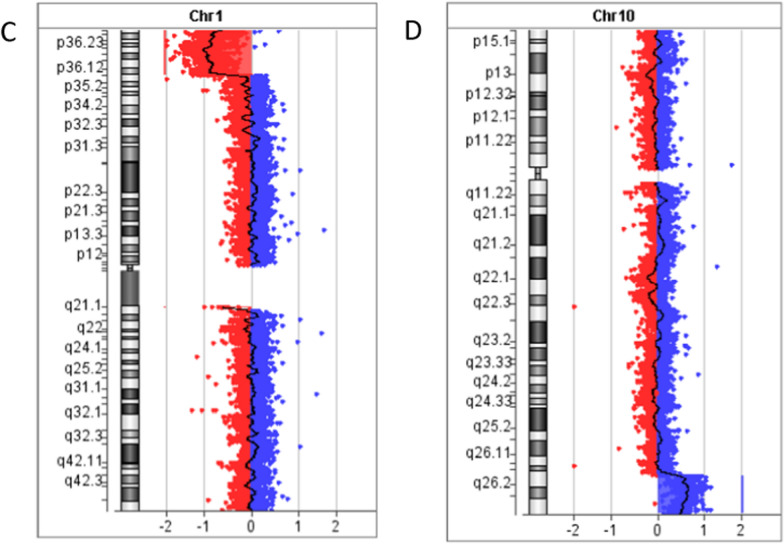 Optical genome mapping enhances cytogenetic analysis in recurrent miscarriage: confirmation of a suspected (1;10) chromosomal translocation.