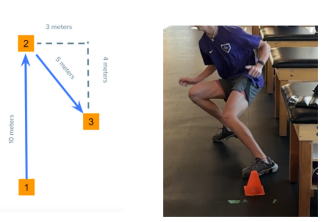 The Deceleration Dilemma: Leveraging The Relationship Between Quadriceps Function and Deceleration to Optimize Return to Sport.