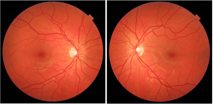 SCONe: a community-acquired retinal image repository enabling ocular, cardiovascular and neurodegenerative disease prediction.