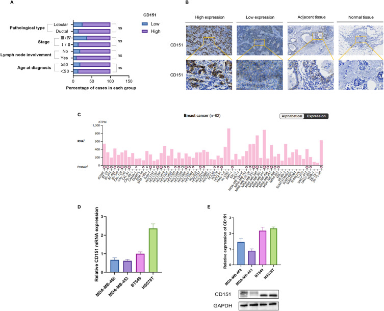 CD151 Promotes Cancer Progression in Triple-Negative Breast Cancer by Inducing EMT through the MAPK Signaling Pathway.
