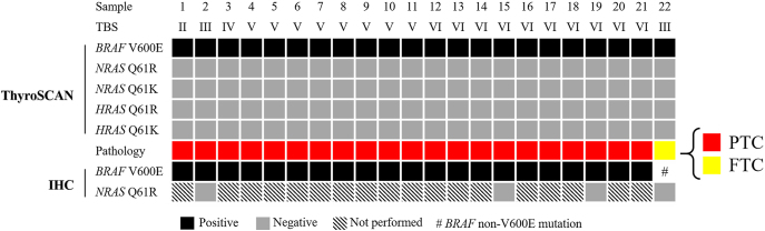 Validation of preoperative BRAF V600E testing by ThyroSCAN PanelChip in thyroid nodules.