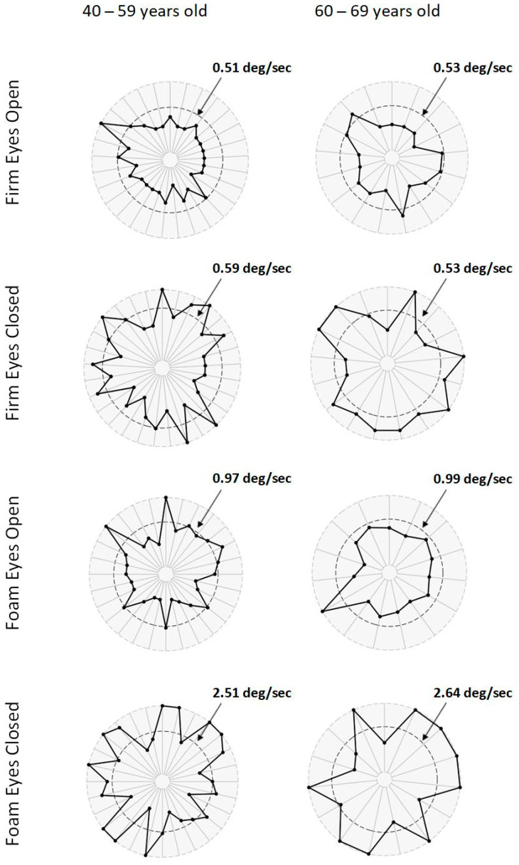 Evaluation of Sensory and Motor Function in Spinal and Bulbar Muscular Atrophy Using Quiet Stance and Reactive Postural Control.