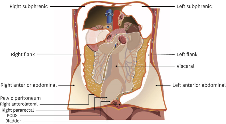 Current peritonectomy practice during debulking surgery in patients with newly diagnosed advanced ovarian cancer: a Korean Gynecologic Oncology Group Study (KGOG 4004).
