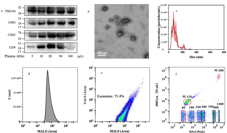 [Enriching plasma exosomes for proteomic analysis using a phosphatidylserine-imprinted polymer].