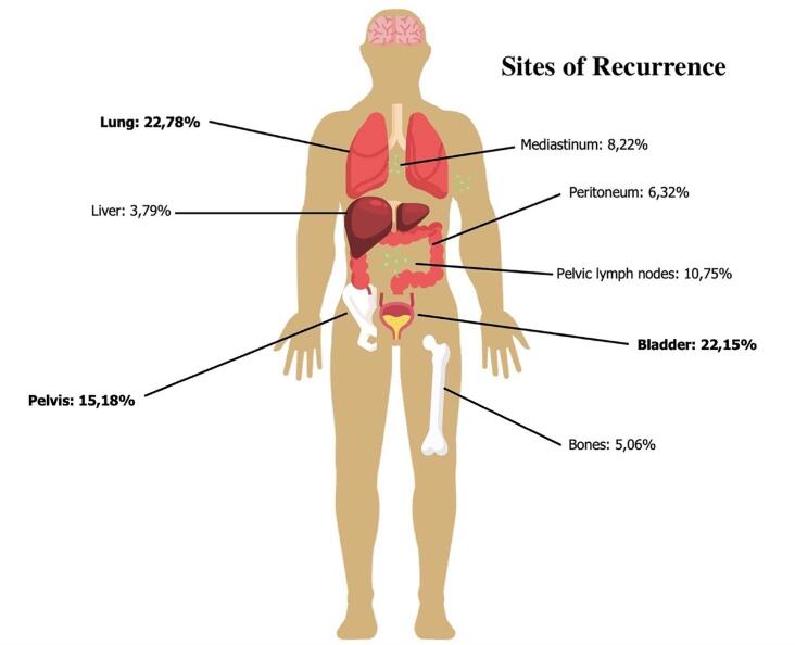 Urachal Carcinomas: A Comprehensive Systematic Review and Meta-analysis.