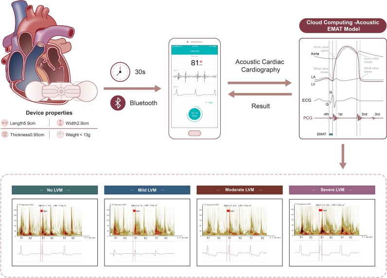 A new wearable e monitoring technology for evaluation of left ventricular remodeling after transcatheter aortic valve replacement.