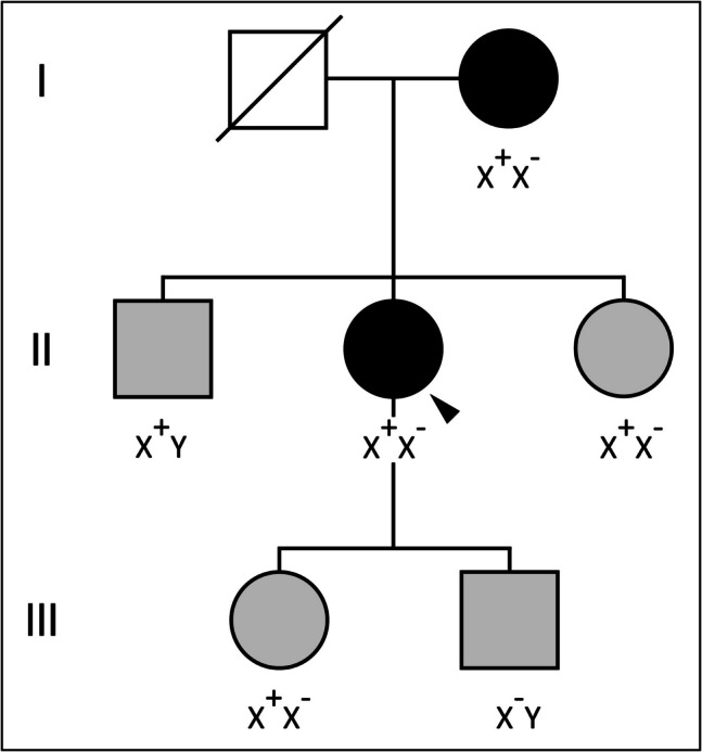 From Rare to Common: Genetic Insights into TLR7 Variants in a Multicentric Spanish Study on COVID-19 Severity.
