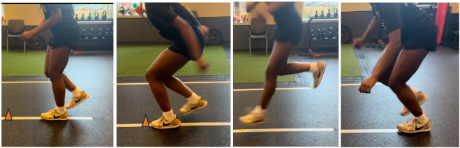 The Deceleration Dilemma: Leveraging The Relationship Between Quadriceps Function and Deceleration to Optimize Return to Sport.