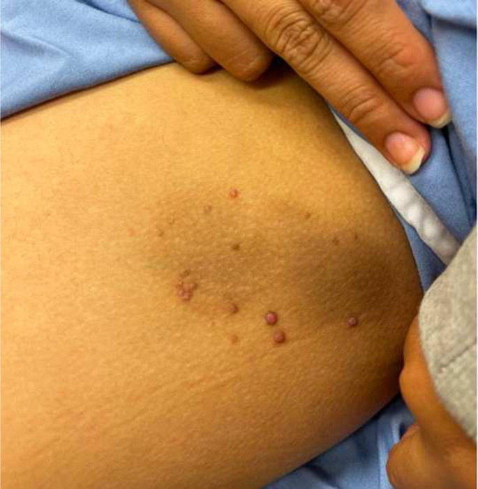 Rosai-Dorfman Disease Case Report.