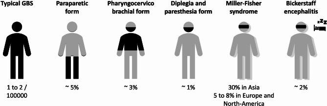 Critical insights for intensivists on Guillain-Barré syndrome.