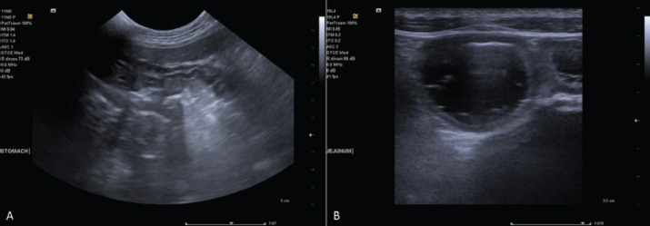 Vitamin K deficiency as a cause of oral bleeding in a dog with intestinal malabsorption due to lymphocytic-plasmacytic enteritis.