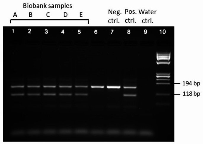 Screening of biobank SNP-array genotyping data to detect Lynch syndrome predisposing MLH1 copy number variants.