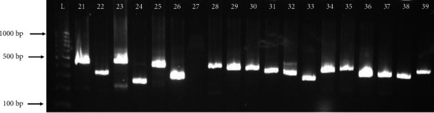 Understanding the Molecular Epidemiology of Community-Acquired Methicillin-Resistant <i>Staphylococcus aureus</i> in Northern Saudi Arabia: A Spotlight on <i>SCCmec</i> and <i>spa</i> Typing.