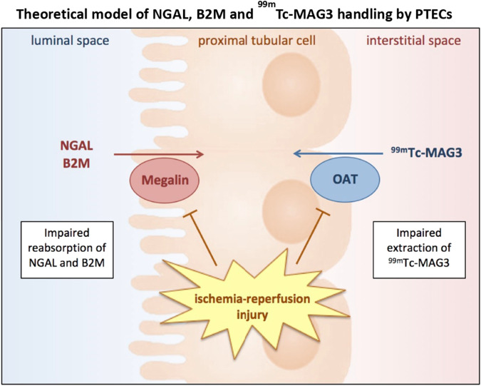 Urinary NGAL Outperforms <sup>99m</sup>Tc-MAG3 Renography in Predicting DCD Kidney Graft Function.