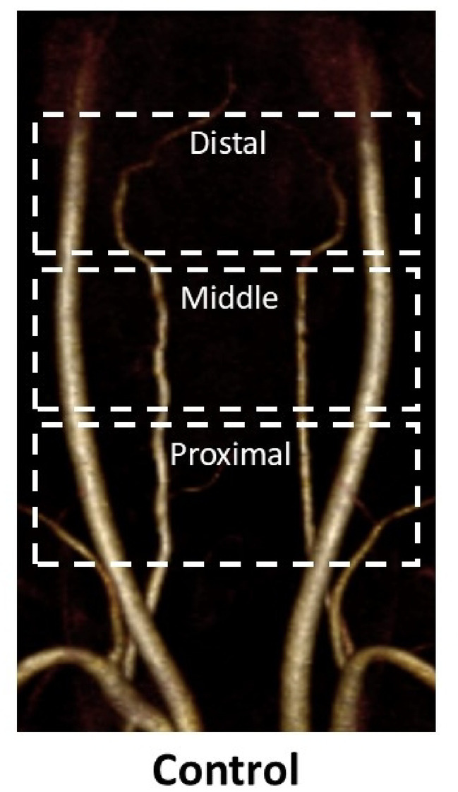 In-vivo assessment of vascular endothelial injury in a rat model of unilateral carotid artery injury using 4D-flow MRI.