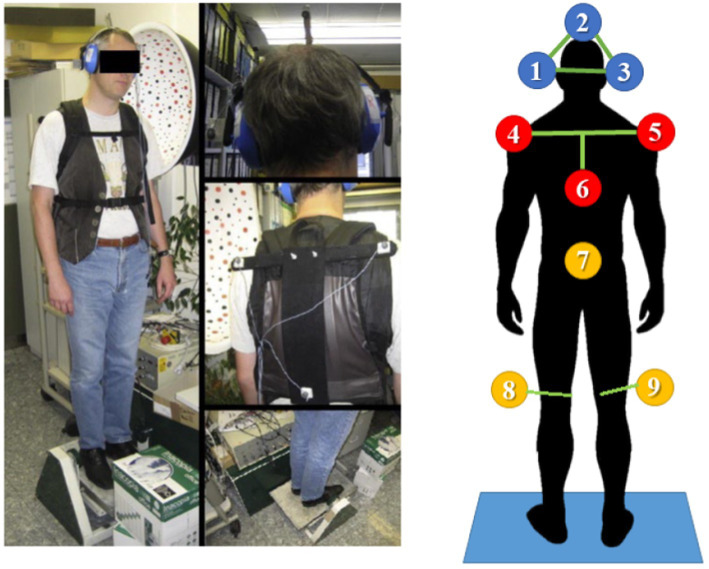 Head posture control under perturbed conditions in progressive supranuclear palsy patients.