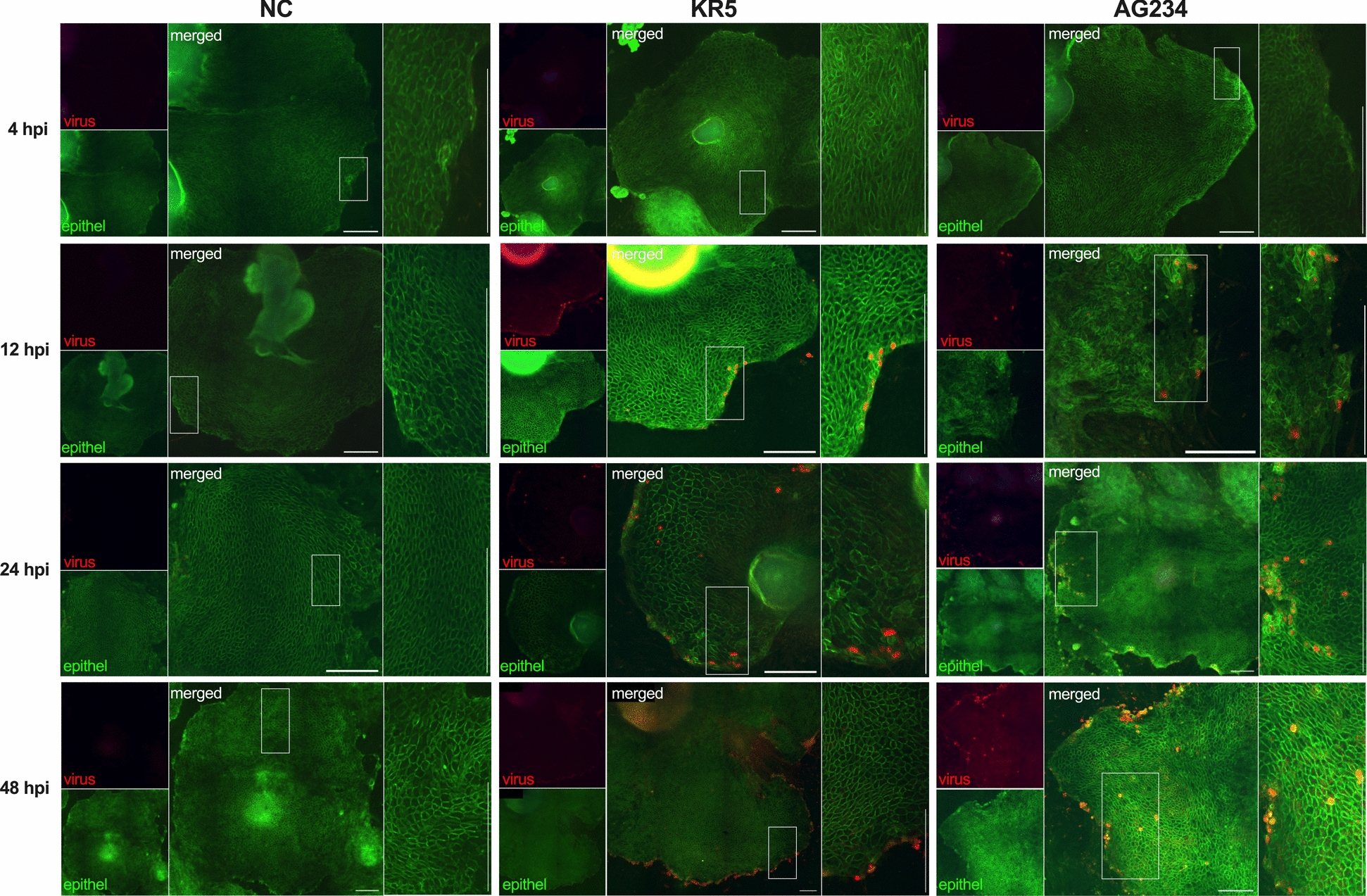 Virulence of fowl adenovirus (FAdV) serotype 4 strains impacts cell proliferation and immune response of primary chicken-embryo intestinal epithelial cells.