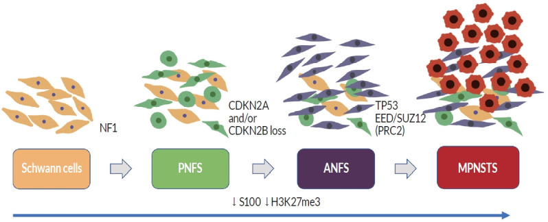 Treatment of Plexiform Neurofibromas : Current Perspectives on Surgery and Medical Treatment.