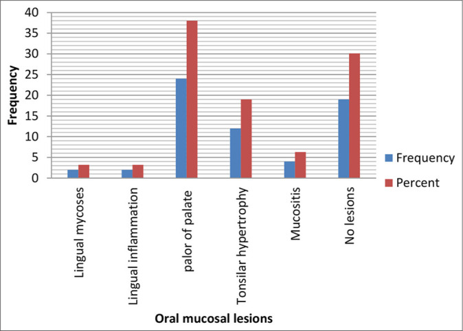 Oral Health Status of People with Sickle Cell Disease at a Major Hospital in Cameroon.