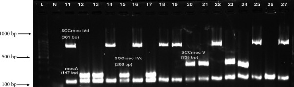 Understanding the Molecular Epidemiology of Community-Acquired Methicillin-Resistant <i>Staphylococcus aureus</i> in Northern Saudi Arabia: A Spotlight on <i>SCCmec</i> and <i>spa</i> Typing.