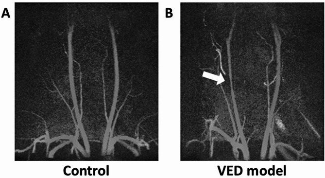 In-vivo assessment of vascular endothelial injury in a rat model of unilateral carotid artery injury using 4D-flow MRI.