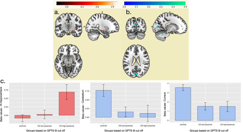 I fear you're getting too close: neural correlates of personal space violation in paranoia.