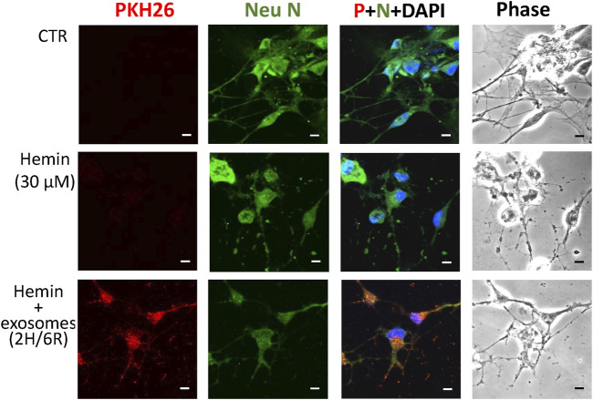 A double-edged effect of hypoxia on astrocyte-derived exosome releases.