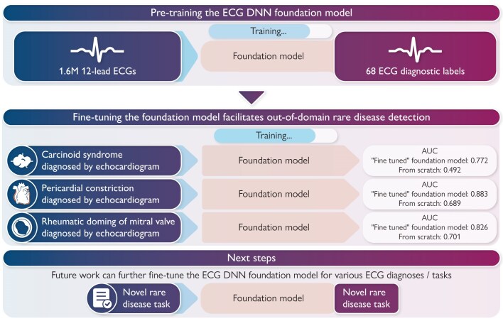 A deep foundation model for electrocardiogram interpretation: enabling rare disease detection through transfer learning.