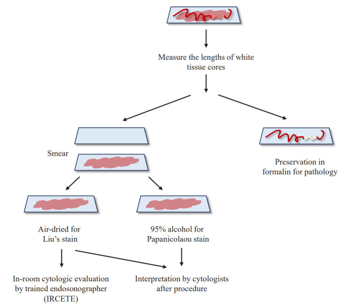 In-room cytologic evaluation by trained endosonographer for determination of procedure end in endoscopic ultrasound-guided fine needle biopsy of solid pancreatic lesions: a prospective study in Taiwan.