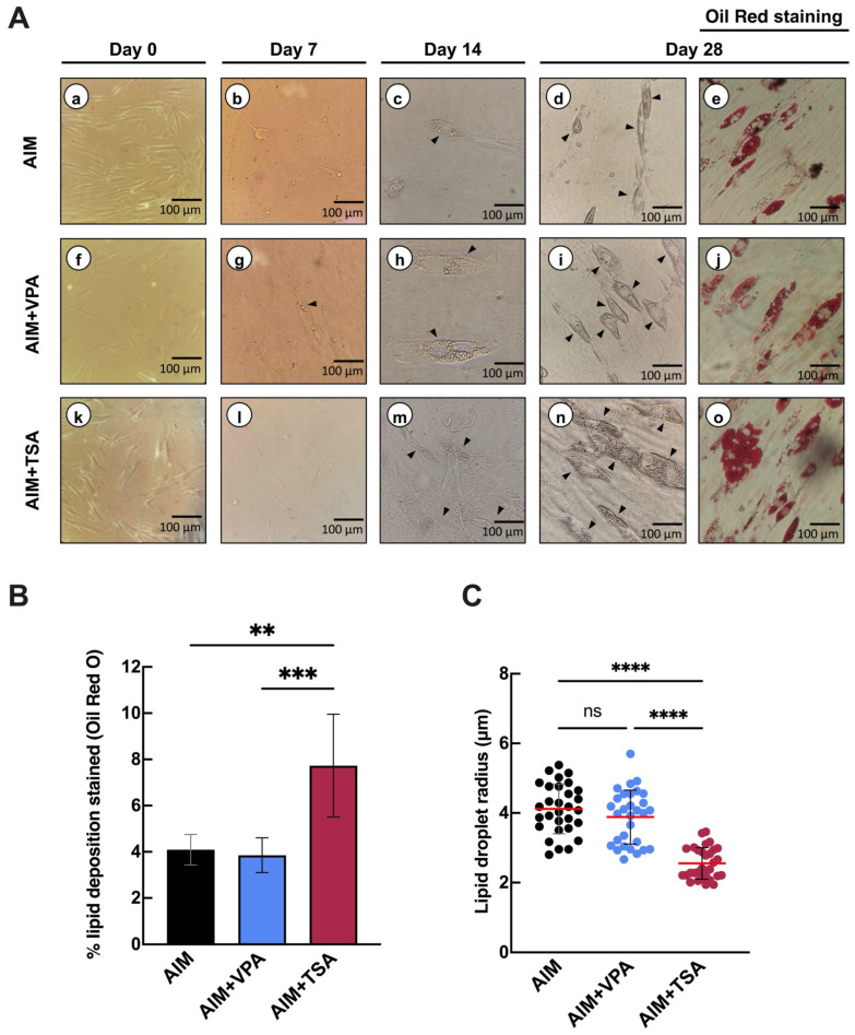 Histone H3 Lysine 9 Acetylation Plays a Role in Adipogenesis of Periodontal Ligament-Derived Stem Cells.