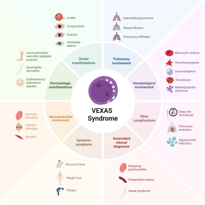 VEXAS Syndrome: An Overlooked Threat.
