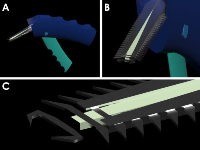 Stapler for corneal transplantation: a hypothesis.