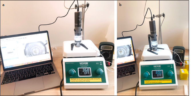 In Vitro Evaluation of Bovine Pulp Dissolution Using Dual Rinse HEDP at Different Temperatures.
