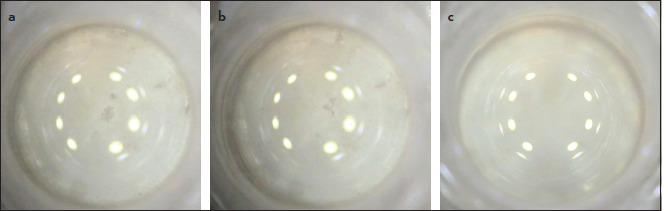 In Vitro Evaluation of Bovine Pulp Dissolution Using Dual Rinse HEDP at Different Temperatures.