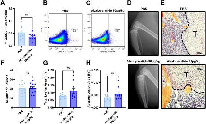 Abaloparatide increases bone mass without affecting growth of bone-disseminated cancer cells.
