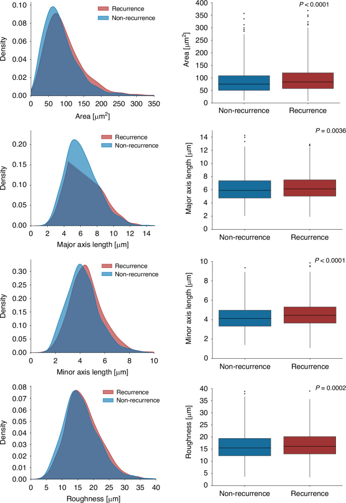 Deep learning-based interpretable prediction of recurrence of diffuse large B-cell lymphoma.