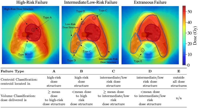 A unified workflow for classifying patterns of locoregional failure using radiotherapy treatment planning dose distributions.