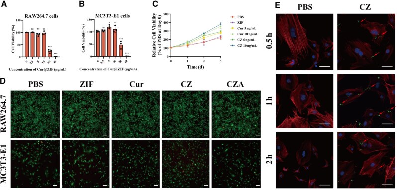 An acid-responsive bone-targeting nanoplatform loaded with curcumin balances osteogenic and osteoclastic functions.
