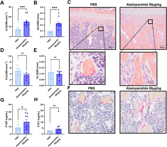 Abaloparatide increases bone mass without affecting growth of bone-disseminated cancer cells.