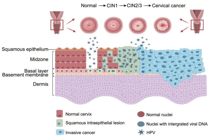 Targeting HPV for the prevention, diagnosis, and treatment of cervical cancer.