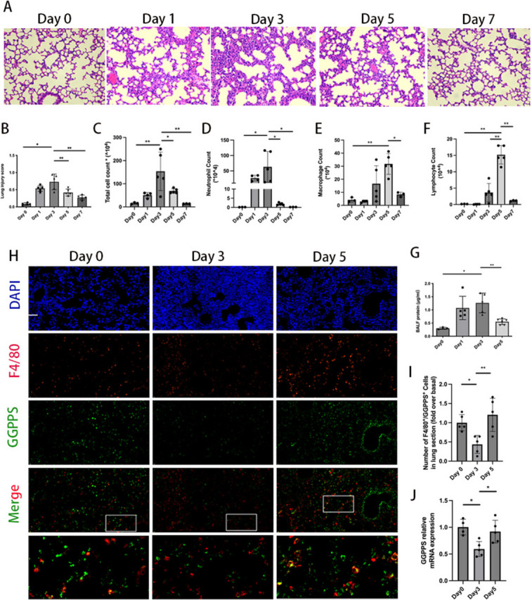 Geranylgeranyl diphosphate synthase deficiency impairs efferocytosis and resolution of acute lung injury.